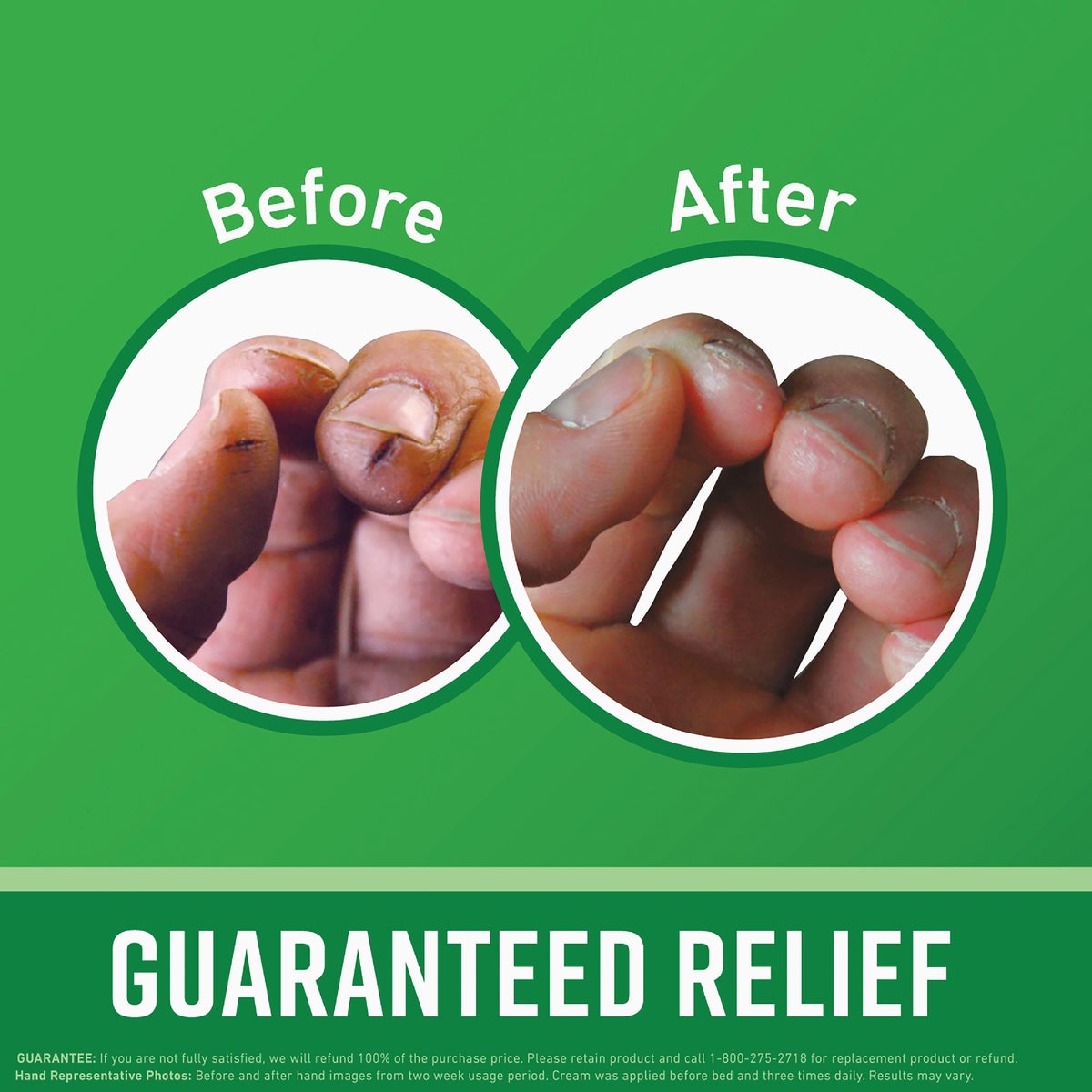 O'Keeffe's Working Hands 6.8 Oz. Jar Hand Cream Image 2